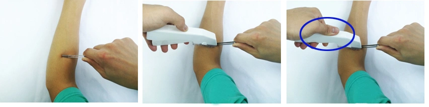Grapadoras de la piel médica disponible y removedores quirúrgicos de la grapadora con CE