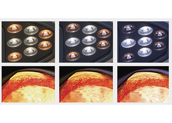 luz de funcionamiento quirúrgica Shadowless 180VA 4500K de 10000lux LED